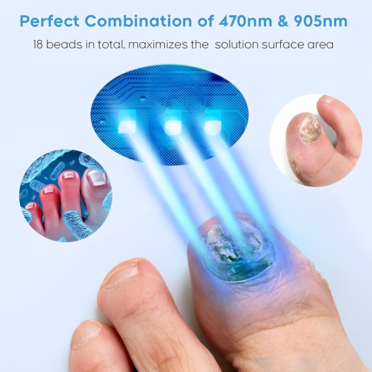 50% DE REMISE TEMPORAIRE | NailRenew™ | Lutter et éliminer les mycoses des ongles !