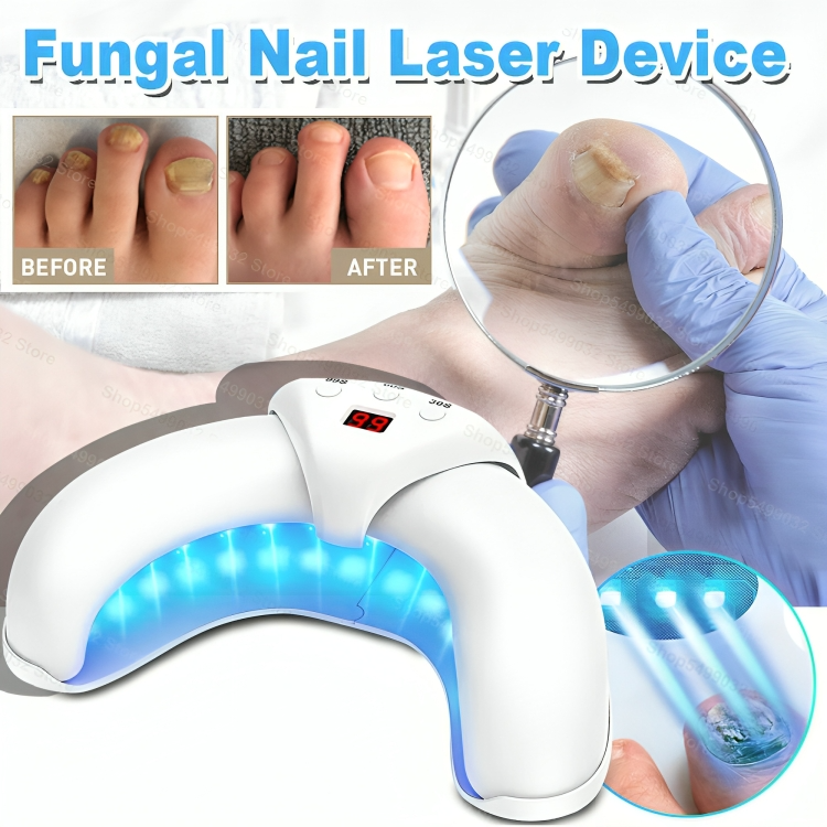 50% DE REMISE TEMPORAIRE | NailRenew™ | Lutter et éliminer les mycoses des ongles !