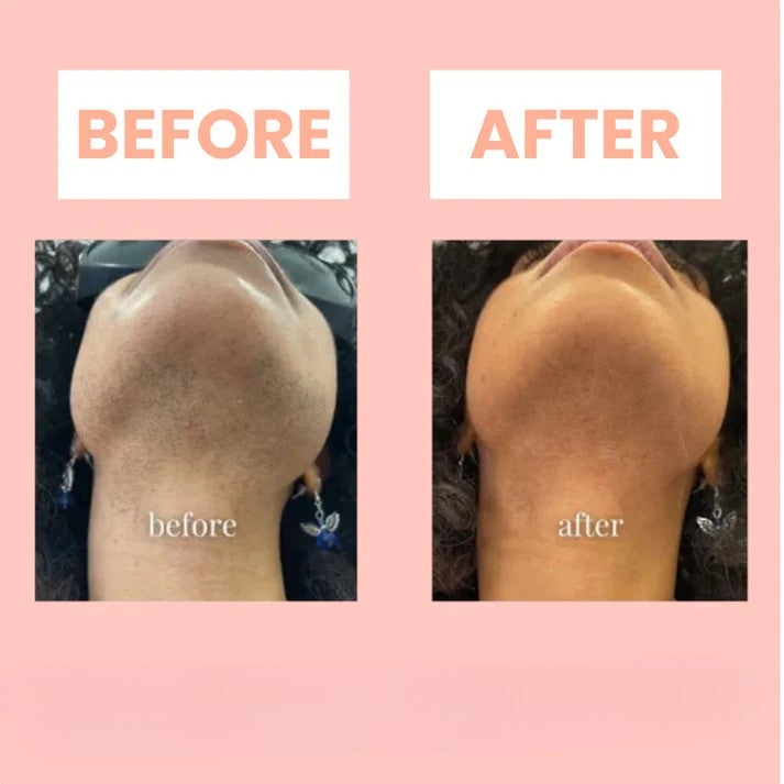 1 + 1 GRATUIT AUJOURD'HUI | BareSmooth™ | Crème dépilatoire pour femmes
