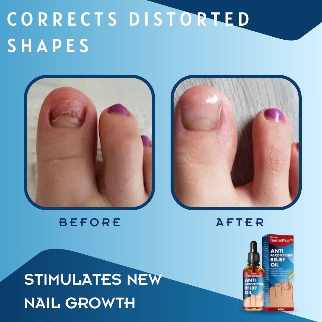 1 + 1 GRATUIT AUJOURD'HUI | ToePerfect™