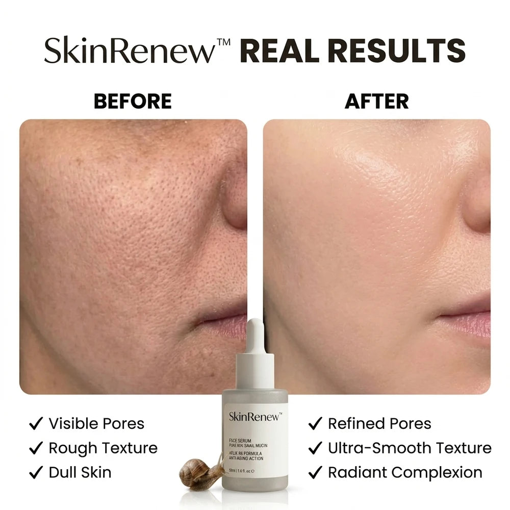 50 % DE REMISE TEMPORAIRE | SkinRenew™ - Renouvellement de l’éclat