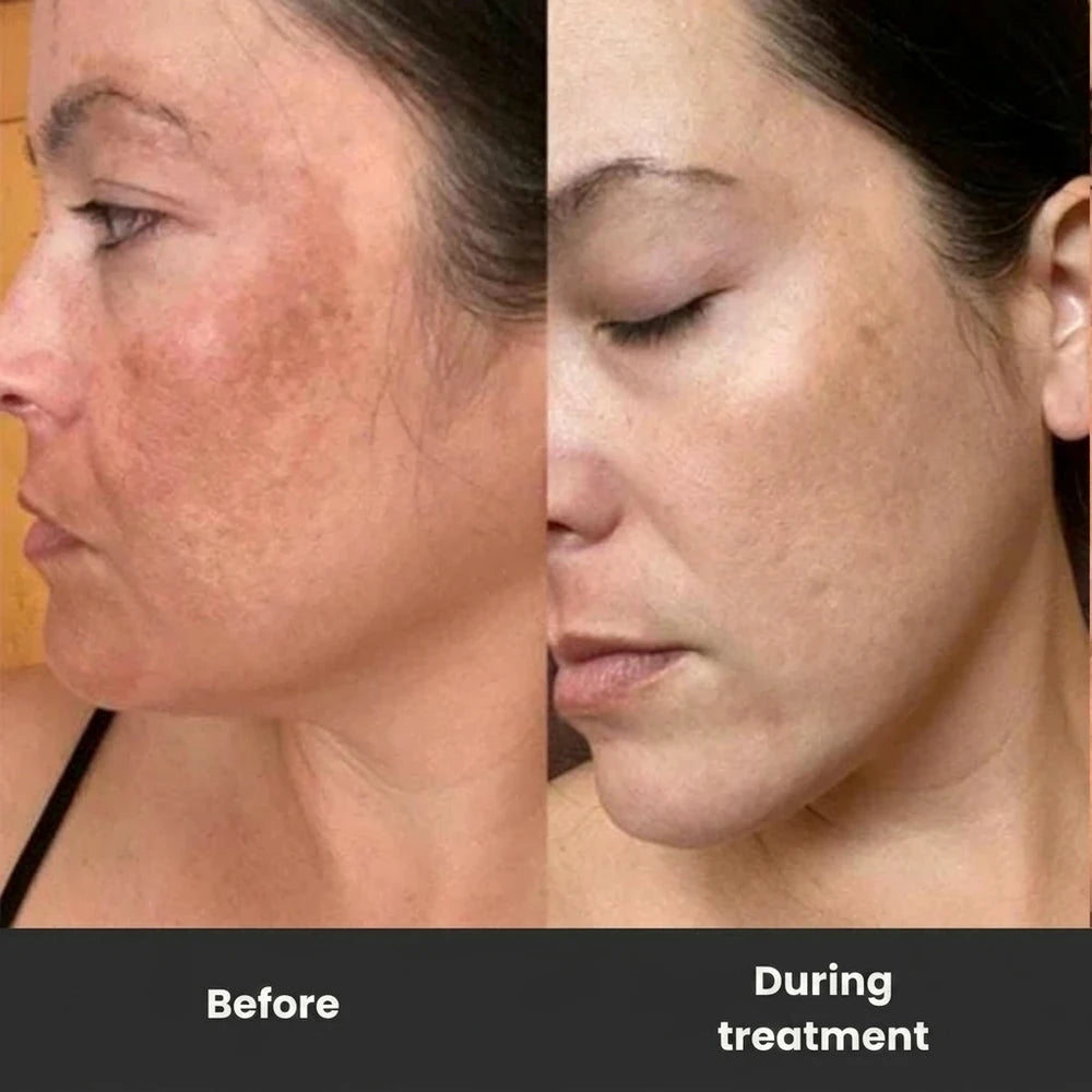 50 % DE REMISE TEMPORAIRE | SkinRenew™ - Renouvellement de l’éclat