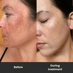 -50 % · OFFRE LIMITÉE · SkinRenew™ · Renouvellement de l’éclat