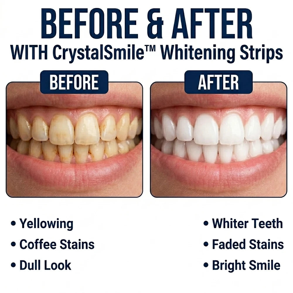 1 + 1 GRATUIT AUJOURD'HUI | CrystalSmile™ - Bandes de blanchiment dentaire