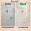 -50 % · OFFRE LIMITÉE · ClearMole™ · Détachant de verrues et d’acrochordons