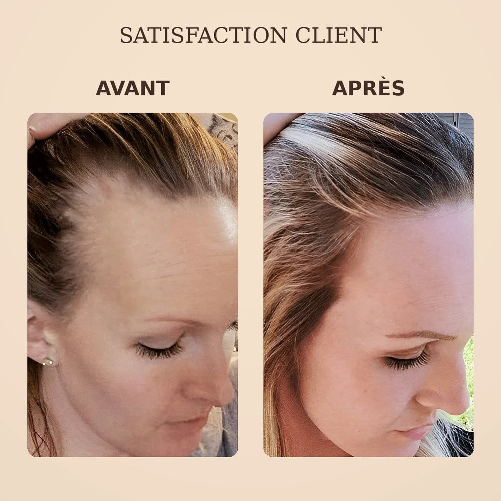 1+1 OFFERT · AUJOURD'HUI · SorcerySoap™ · Barre de shampoing anti-chute de cheveux