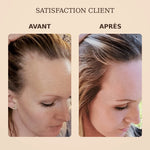 1+1 OFFERT · AUJOURD'HUI · SorcerySoap™ · Barre de shampoing anti-chute de cheveux