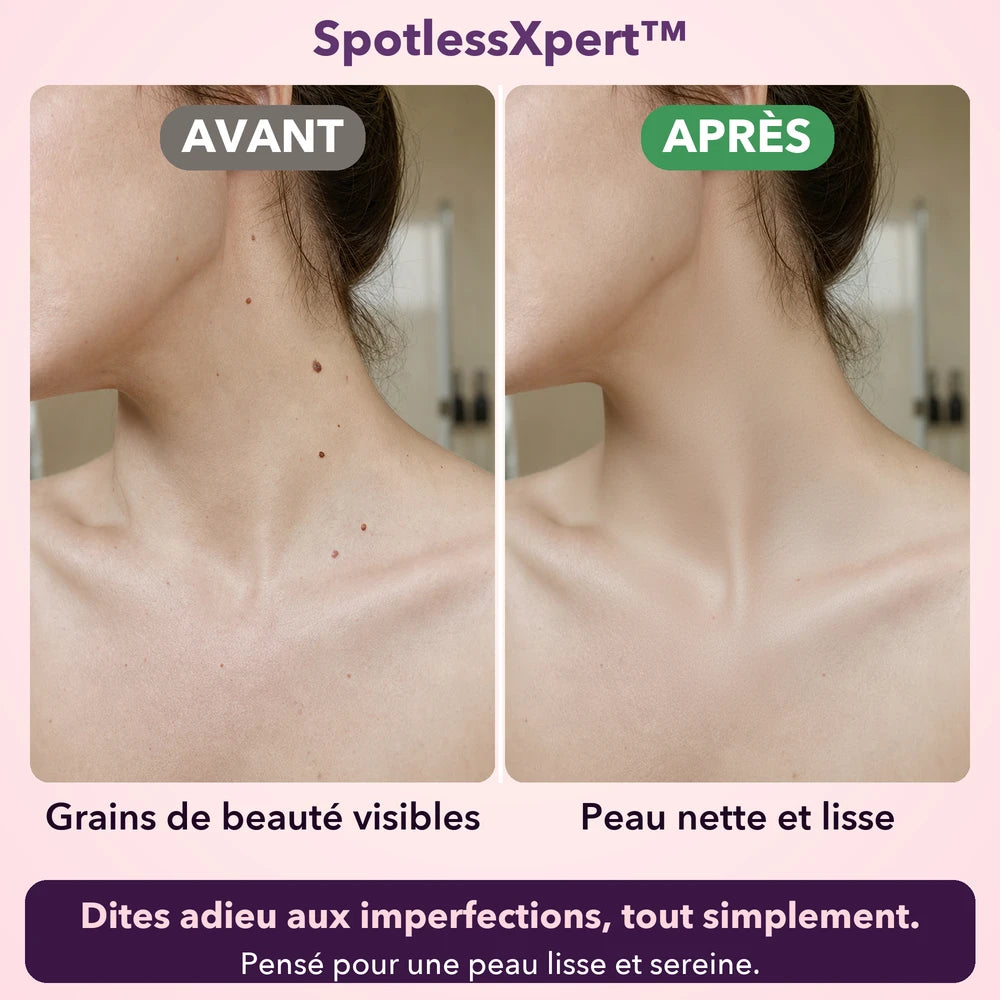 -50 % · OFFRE LIMITÉE · SpotlessXpert™ · Appareil électrique anti-imperfections