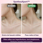 -50 % · OFFRE LIMITÉE · SpotlessXpert™ · Appareil électrique anti-imperfections