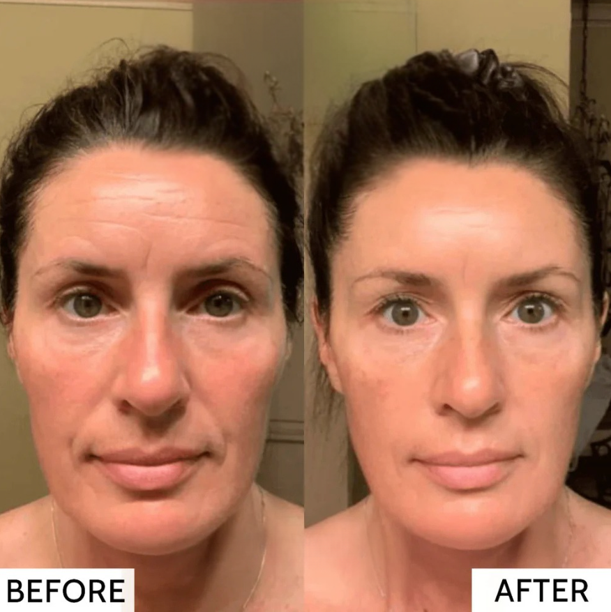 50 % DE RABAIS TEMPORAIRE | RevitaMask™ | Masque de collagène pour la peau