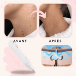 -50 % · OFFRE LIMITÉE · SpotlessXpert™ · Appareil électrique anti-imperfections