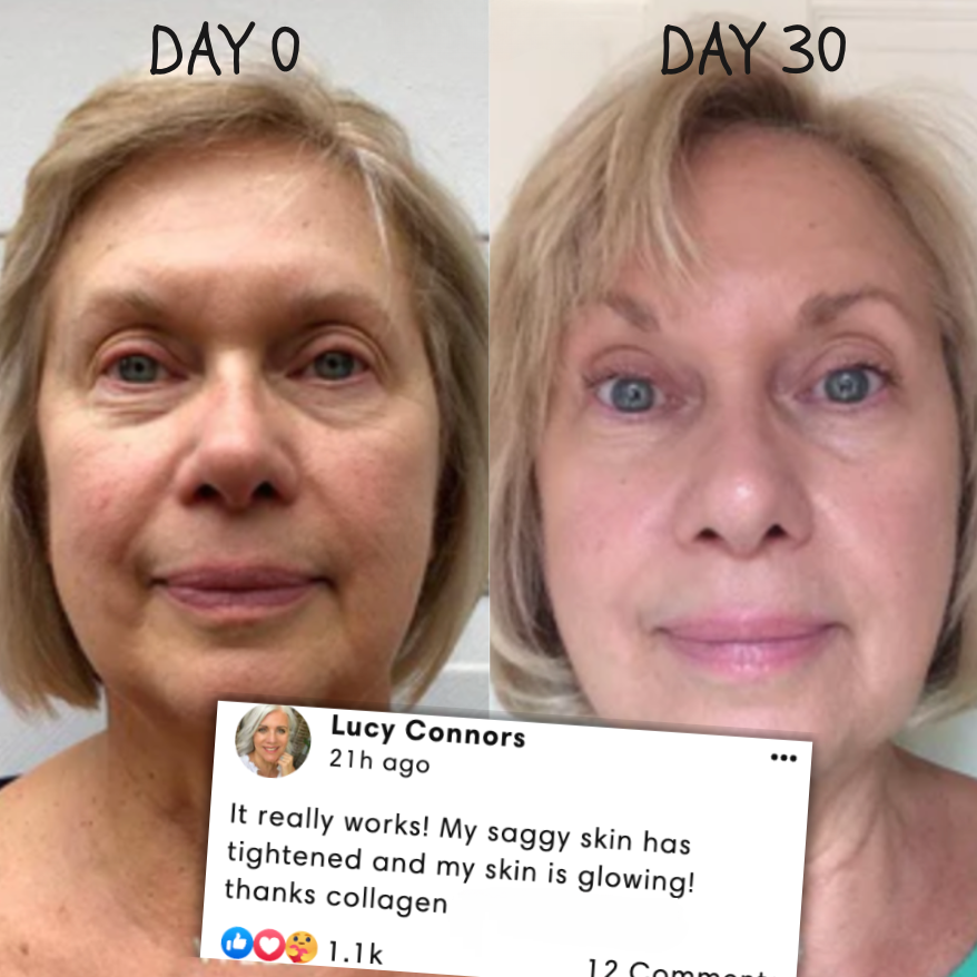50 % DE RABAIS TEMPORAIRE | RevitaMask™ | Masque de collagène pour la peau