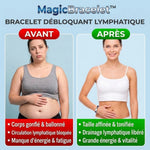 -50 % · OFFRE LIMITÉE · MagicBracelet™ ·  Bracelet de drainage lymphatique