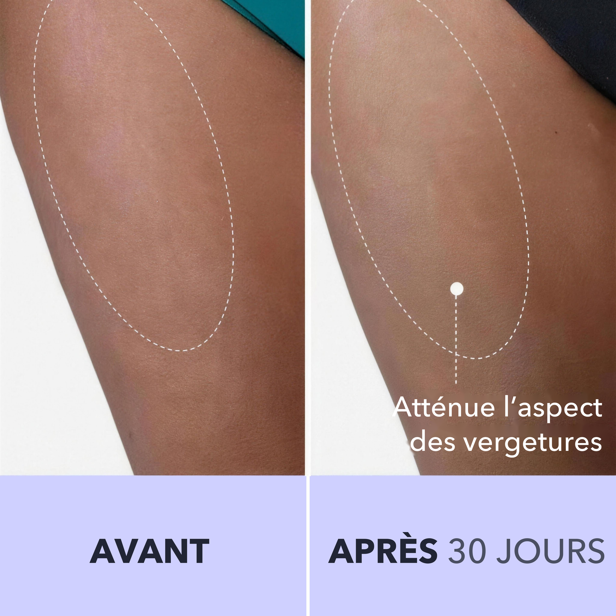 1+1 OFFERT · AUJOURD'HUI · SmoothSculpt™ · Dites bonjour à une peau visiblement plus ferme !