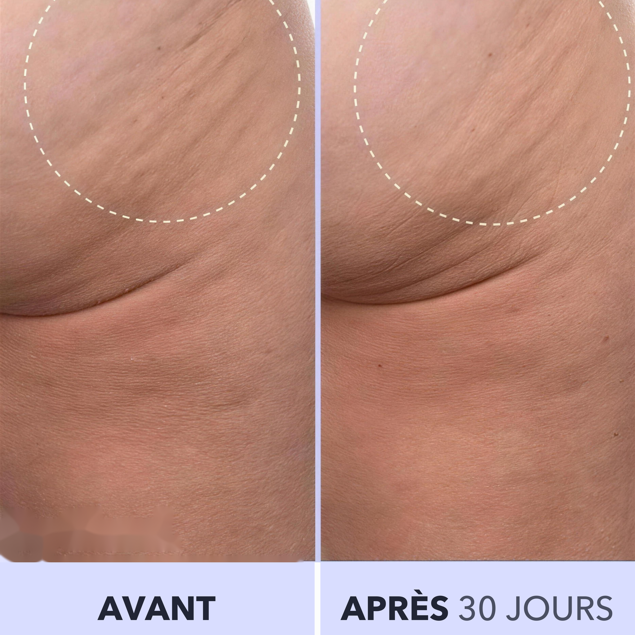1+1 OFFERT · AUJOURD'HUI · SmoothSculpt™ · Dites bonjour à une peau visiblement plus ferme !