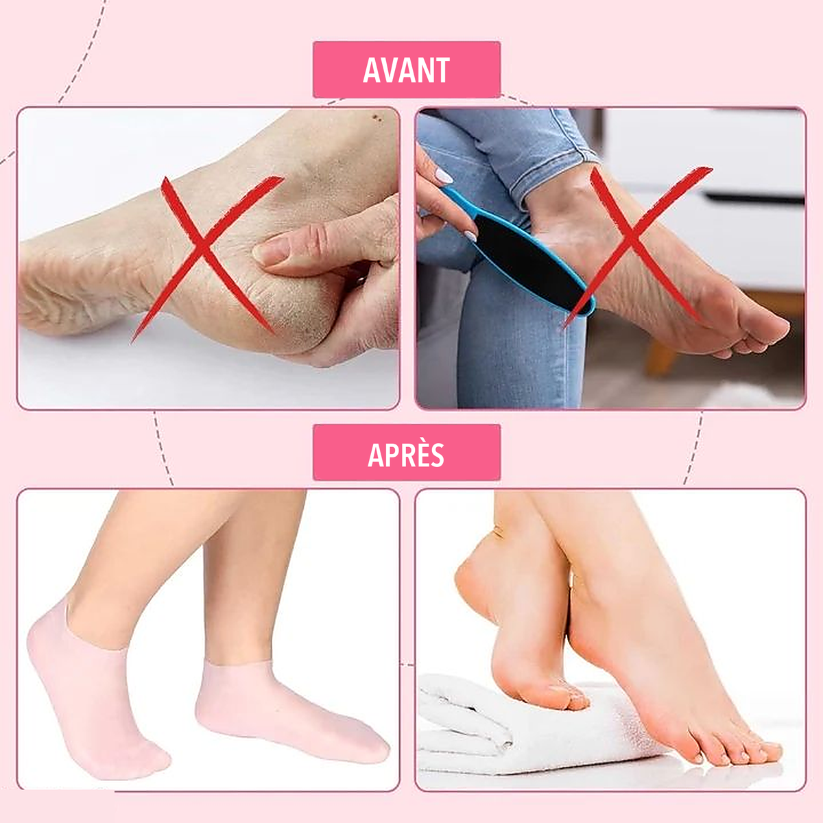 1+1 OFFERT · AUJOURD'HUI · HeelHaven™ · Dites adieu aux talons secs et aux pieds fatigués !