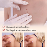 -50 % · OFFRE LIMITÉE · ClearMole™ · Détachant de verrues et d’acrochordons