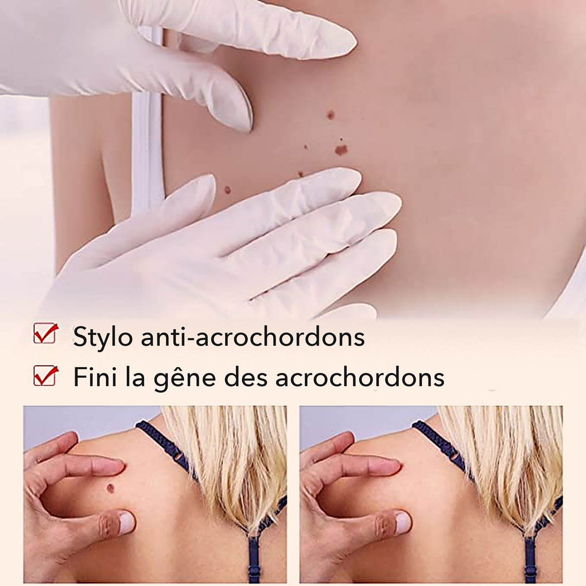 -50 % · OFFRE LIMITÉE · ClearMole™ · Détachant de verrues et d’acrochordons