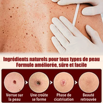 -50 % · OFFRE LIMITÉE · ClearMole™ · Détachant de verrues et d’acrochordons
