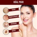 -50 % · OFFRE LIMITÉE · ClearMole™ · Détachant de verrues et d’acrochordons