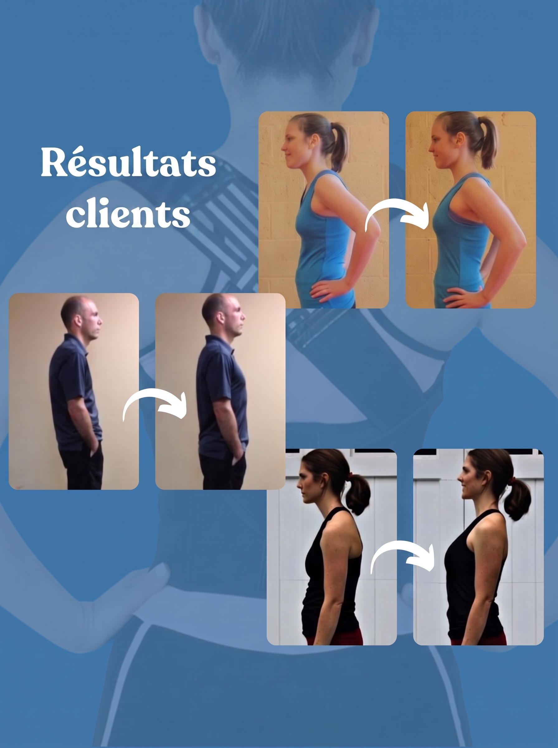 -50 % · OFFRE LIMITÉE · FormFit™ · Correcteur de posture