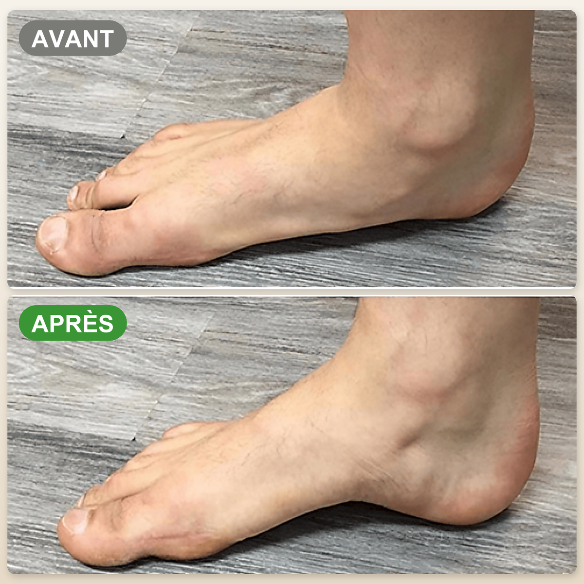 -50 % · OFFRE LIMITÉE · StepRelief™ · Soutien orthopédique de la voûte plantaire