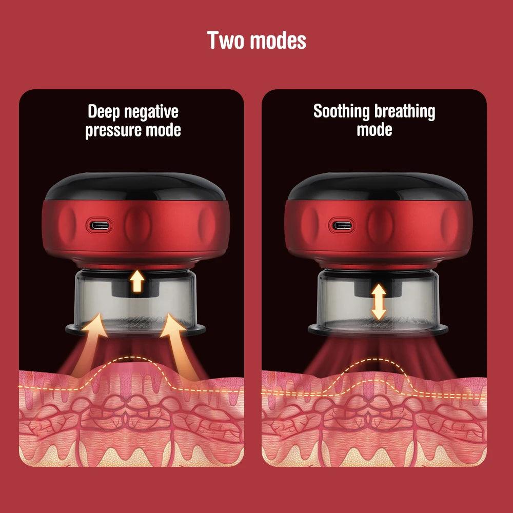 50% RABATT TEMPORÄR | CelluSoothe™ | Elektrisches Anti-Cellulite-Schröpfmassagegerät - MODLIA