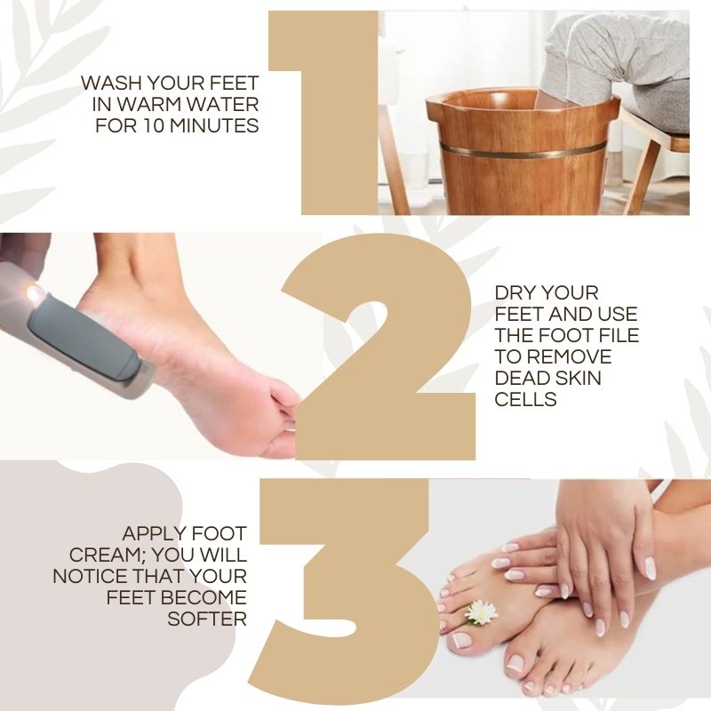 CallusMaster™ - Magicien électrique de callosités | Réduction temporaire de 50%