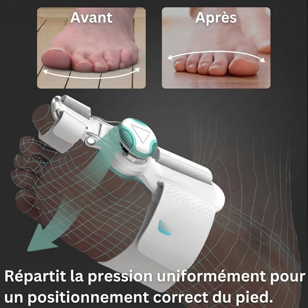 1+1 OFFERT · AUJOURD'HUI · OrthoAlign™ · Correcteur d'hallux valgus