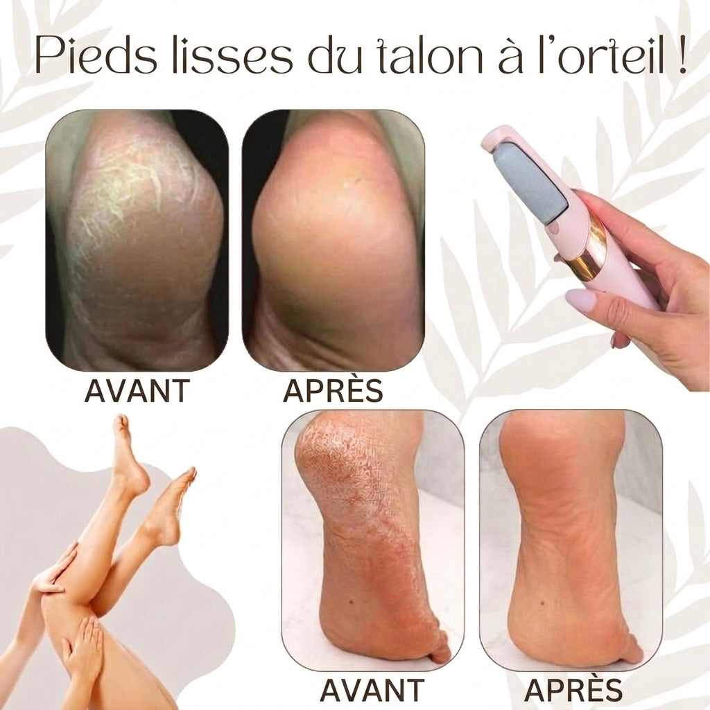 -50 % · OFFRE LIMITÉE · CallusMaster™ · Lime électrique pour les pieds