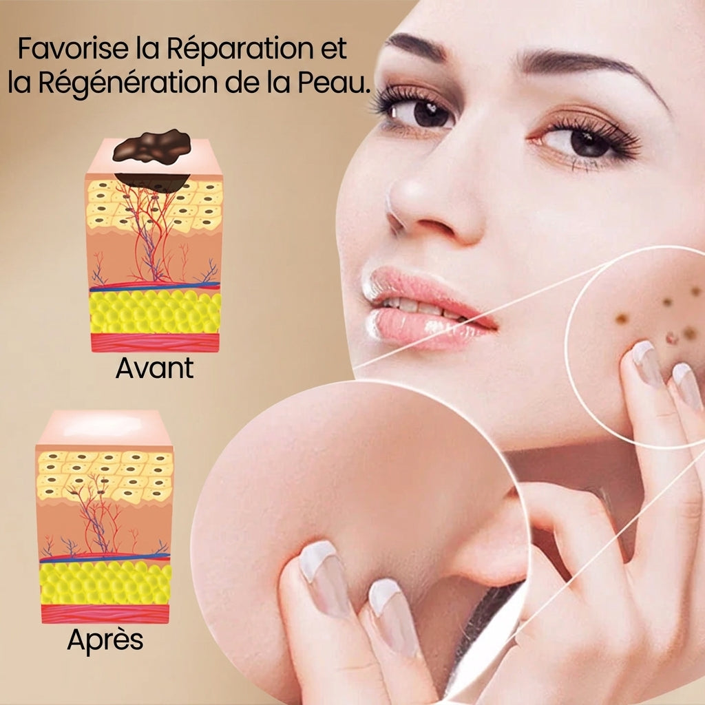 1+1 OFFERT · AUJOURD'HUI · ClearSkin™ · Spray anti-verrues au venin d'abeille