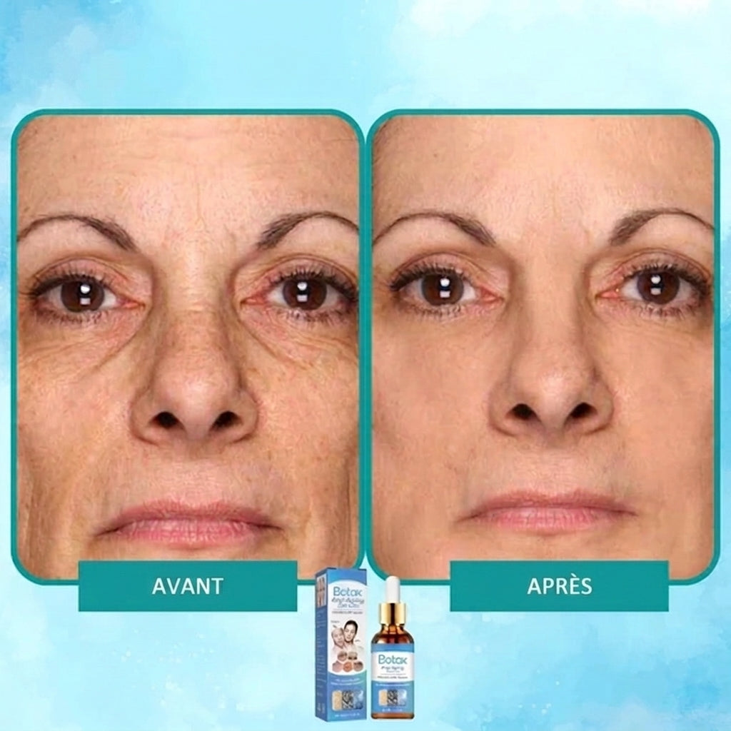 1+1 OFFERT · AUJOURD'HUI · YouthGlow™ · Sérum Anti-Âge Effet Botox