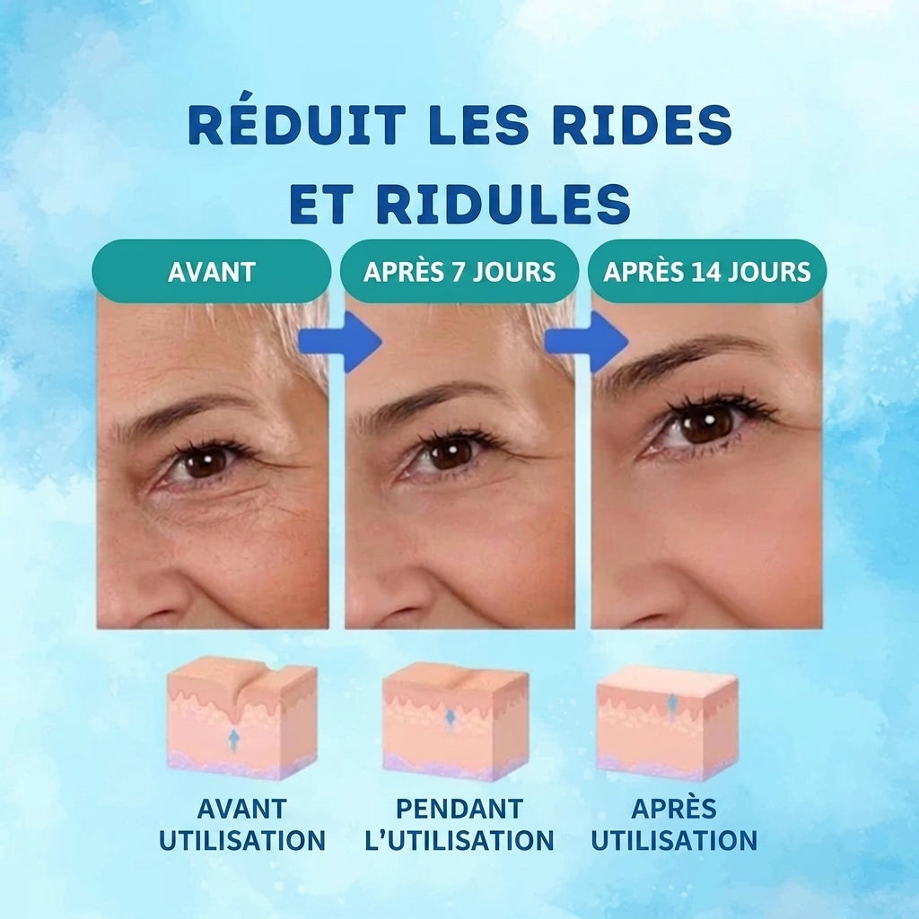 1+1 OFFERT · AUJOURD'HUI · YouthGlow™ · Sérum Anti-Âge Effet Botox