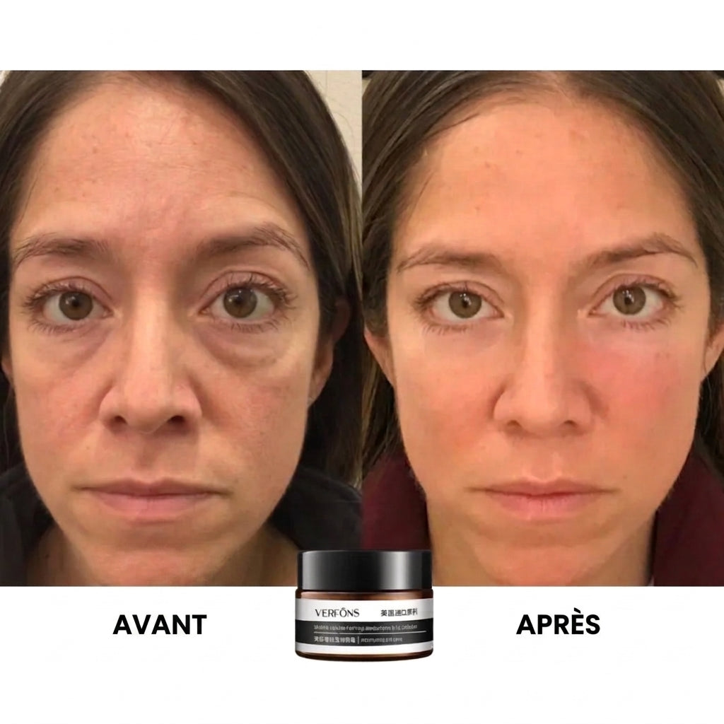 1+1 OFFERT · AUJOURD'HUI · EyeRejuv™ · Crème contour des yeux