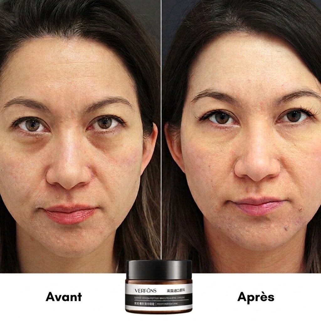 1+1 OFFERT · AUJOURD'HUI · EyeRejuv™ · Crème contour des yeux