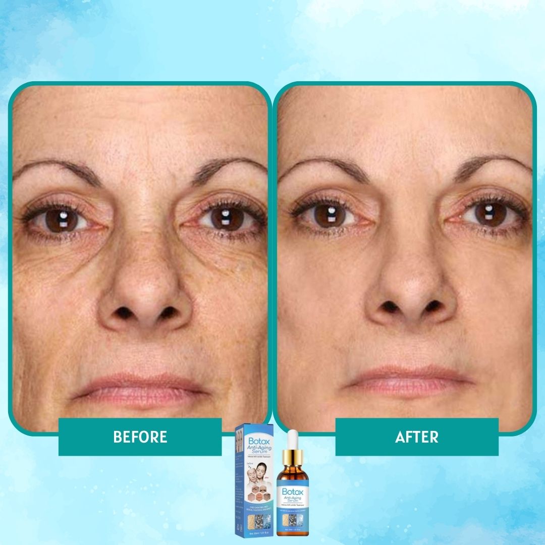 1 + 1 GRATUIT AUJOURD'HUI | YouthGlow™