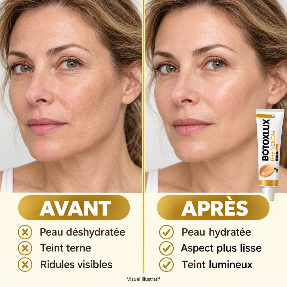 1+1 OFFERT · AUJOURD'HUI · BotoxLux™ · Crème au venin d’abeille