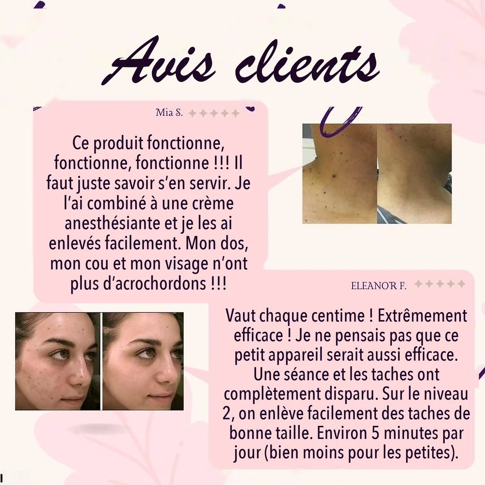 -50 % · OFFRE LIMITÉE · SpotlessXpert™ · Appareil électrique anti-imperfections