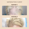 1+1 OFFERT · AUJOURD'HUI · SorcerySoap™ · Barre de shampoing anti-chute de cheveux