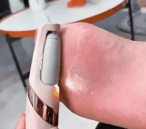 -50 % · OFFRE LIMITÉE · CallusMaster™ · Lime électrique pour les pieds