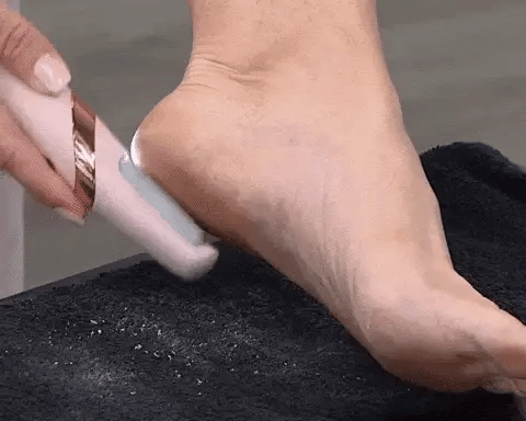 -50 % · OFFRE LIMITÉE · CallusMaster™ · Lime électrique pour les pieds