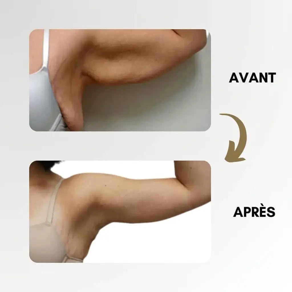 -50 % · OFFRE LIMITÉE · LymphMag™