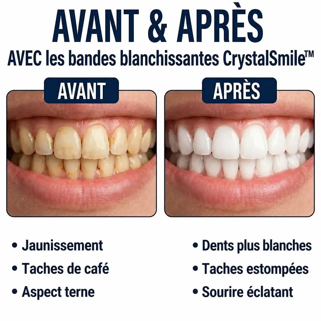 1+1 OFFERT · AUJOURD'HUI · CrystalSmile™ · Bandes de blanchiment dentaire