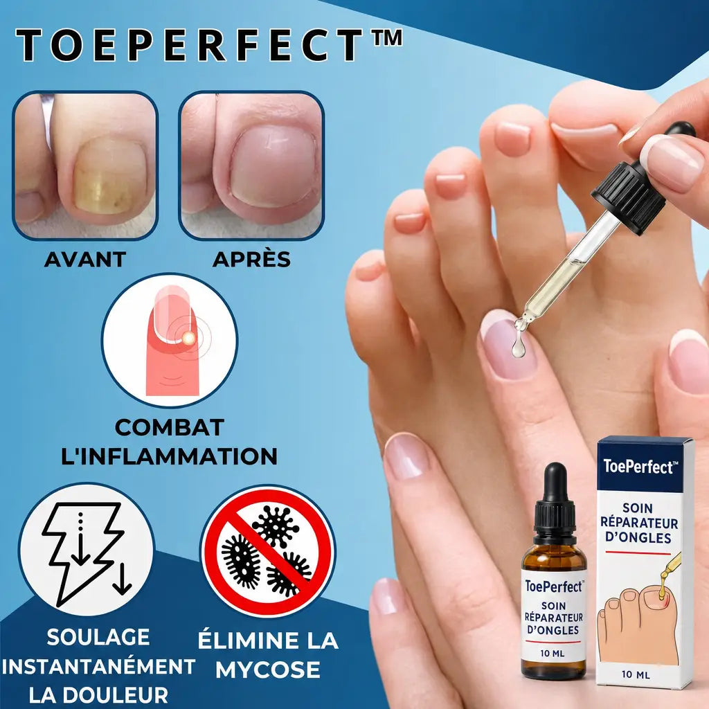 ToePerfect avant apres
