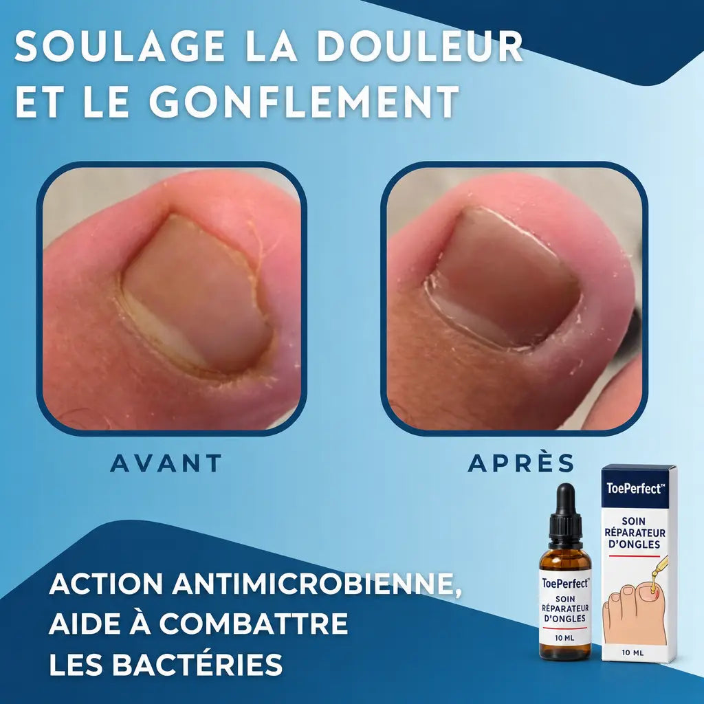 ToePerfect soulage la douleur et le gonflement