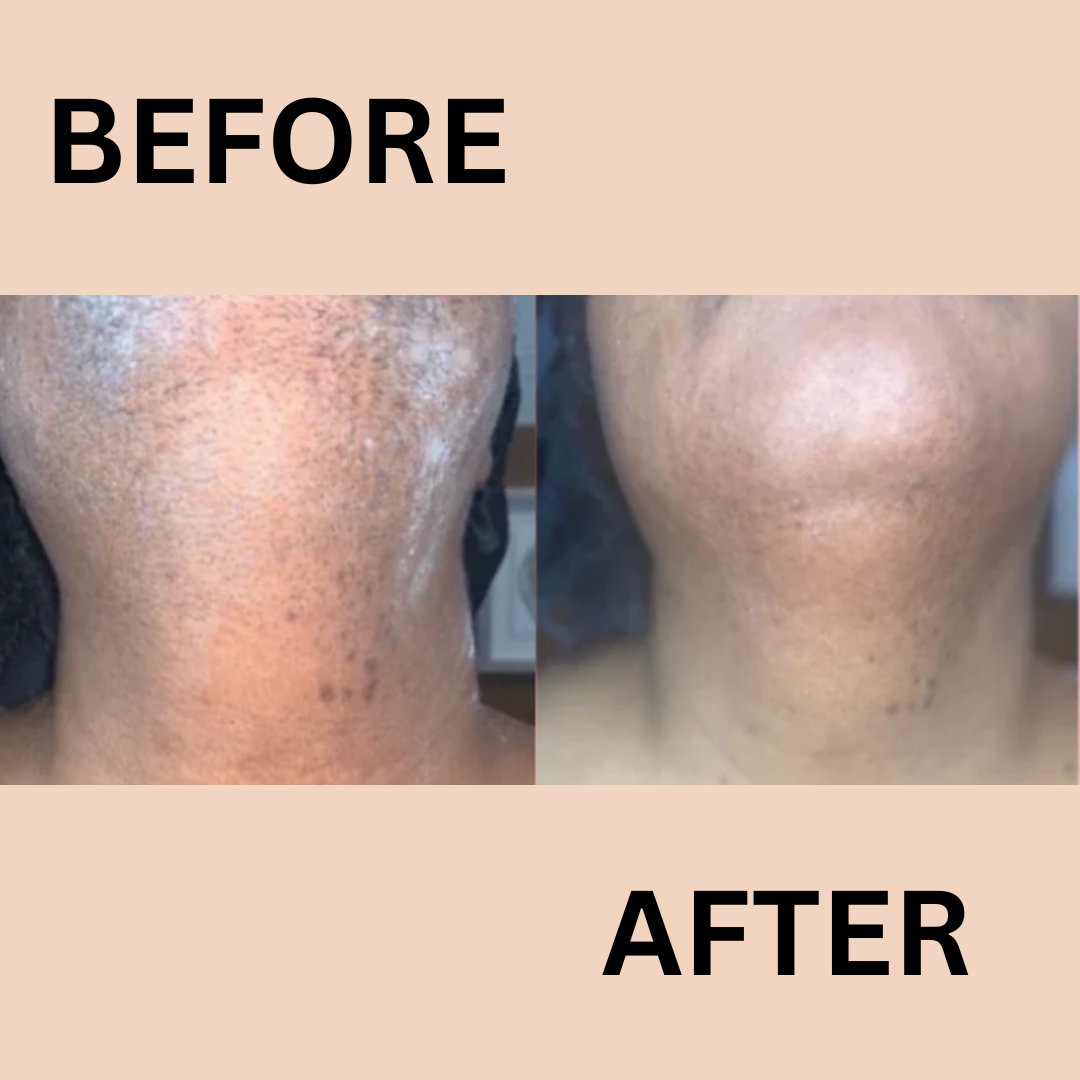 1 + 1 GRATUIT AUJOURD'HUI | BareSmooth™ | Crème dépilatoire pour femmes