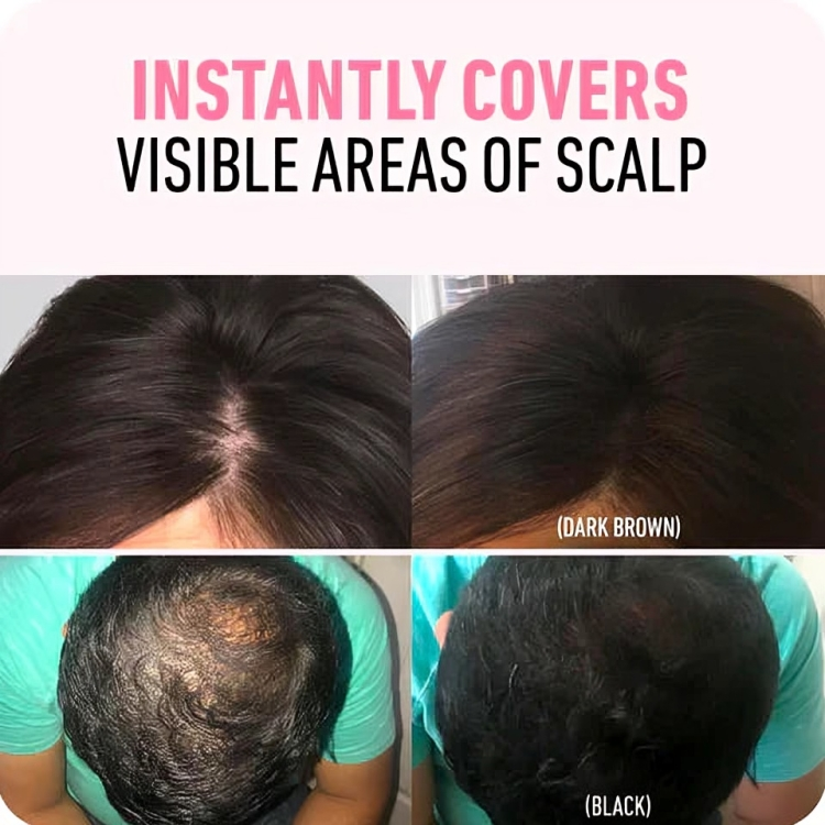 1 + 1 GRATUIT AUJOURD'HUI | GreyGone™ | Poudre de ligne de cheveux