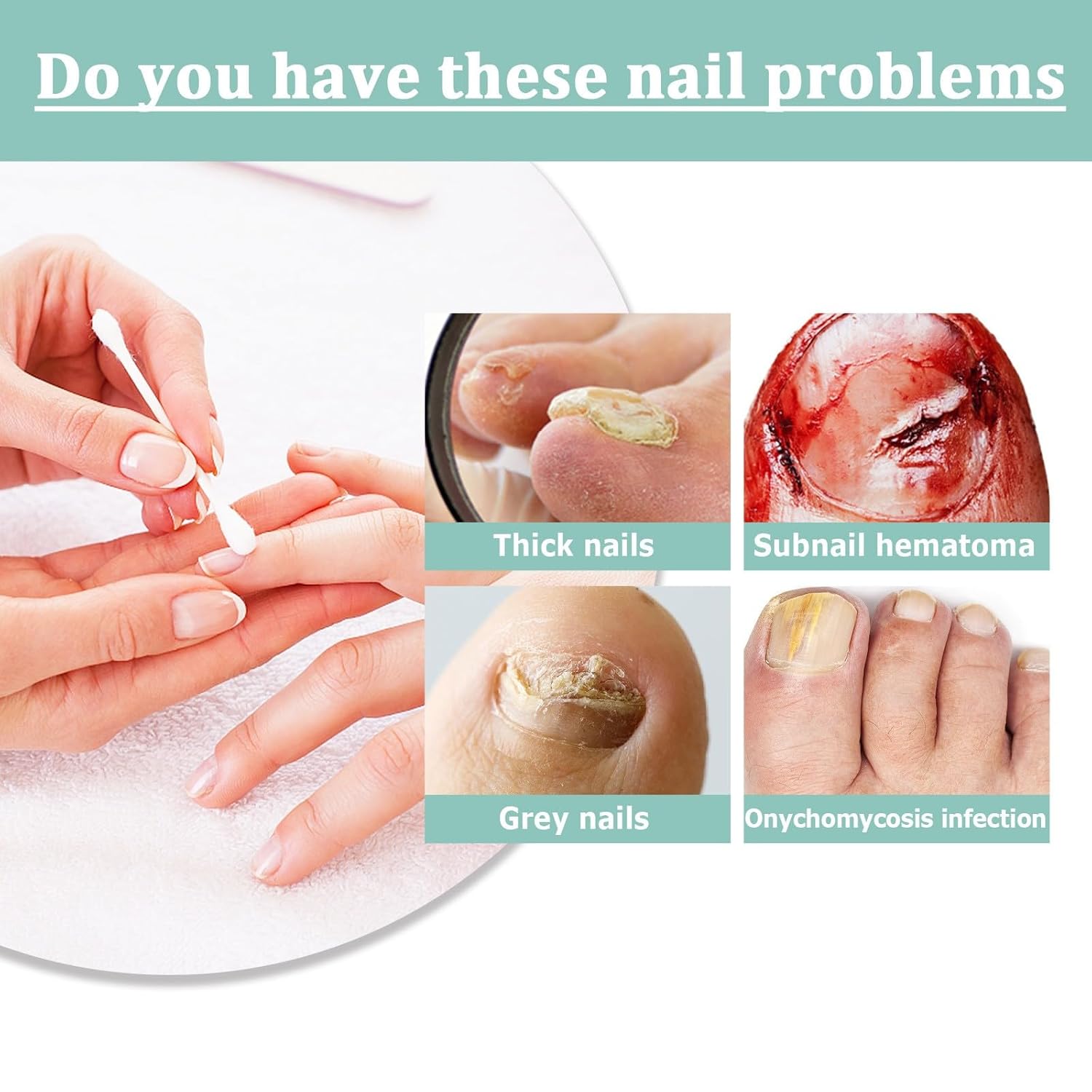 1 + 2 GRATUIT AUJOURD'HUI | NailEssence™ | Baume à ongles bio