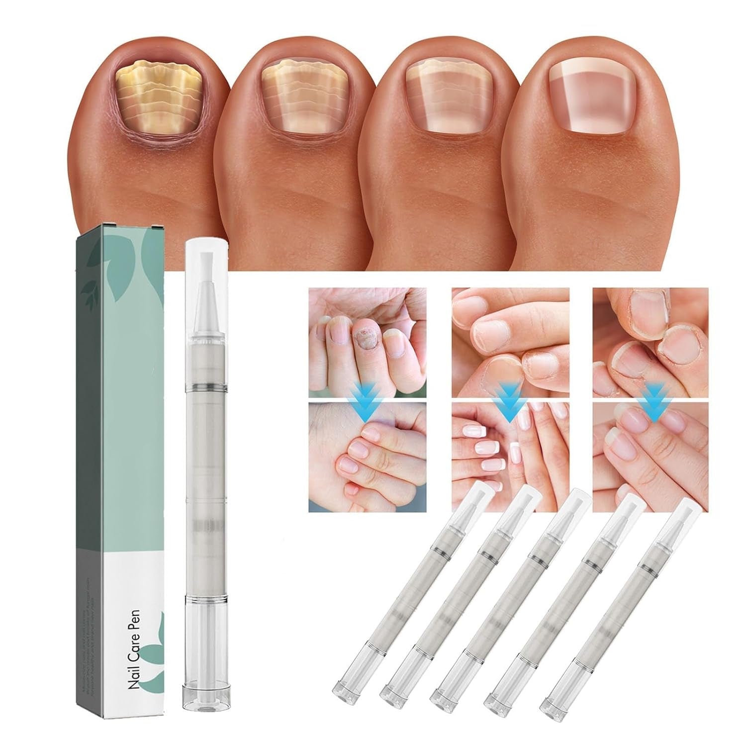 1 + 2 GRATUIT AUJOURD'HUI | NailEssence™ | Baume à ongles bio