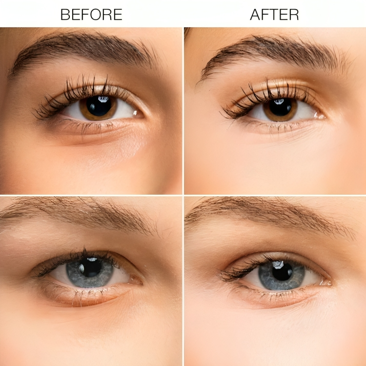 1 + 1 GRATUIT AUJOURD'HUI | GlowGaze™ | Illuminateur pour cernes